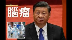 外媒重磅！习近平患脑瘤！只相信中药。或遭政变推翻？北京空气诡谲。美国议员提案严查共产党员