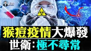 跟「天花」同属一系！“猴痘病毒”半个月传播半个地球，发生惊人变异？“007电影”照进现实了吗；NTI去年神秘报告，准确“预言”当今猴痘传播，推演感染32亿人！美国订千万剂猴痘疫苗｜新闻拍案惊奇 大宇